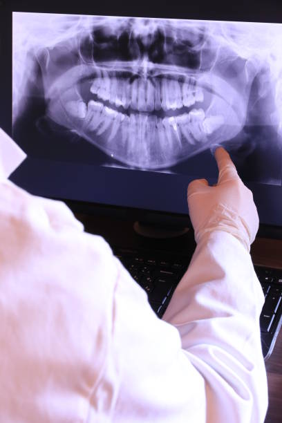 Teeth Whitening in KS