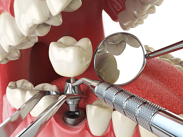 Best Root Canal Emergency Dentist  in Rossville, KS